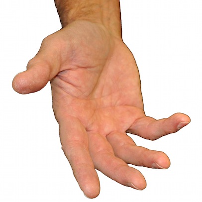 Palm Offer R4 White